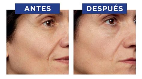 El Retinol La Solución Antiedad Más Eficaz Para Rejuvenecer Sin Pasar