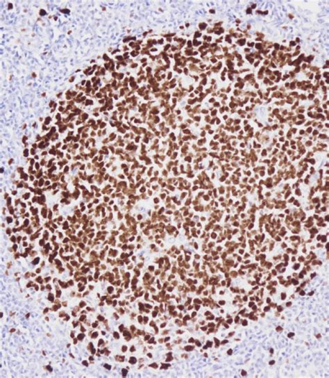 Ki 67 Antibody Purified Mouse Monoclonal Antibody Mab WB IHC P E