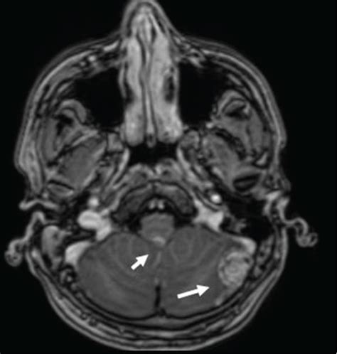 Multisequential Multiplanar Magnetic Resonance Images Of The Brain And