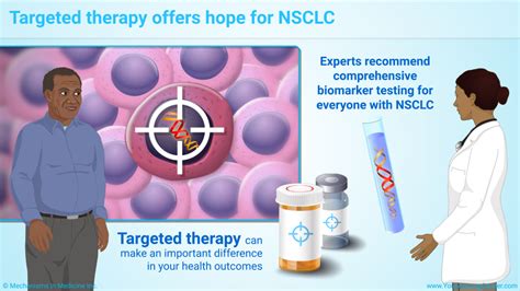 Slide Show - Targeted Therapy in Non-Small Cell Lung Cancer