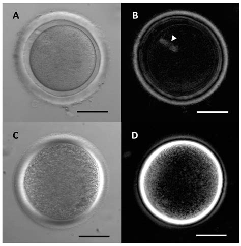 Zona Pellucida Structure