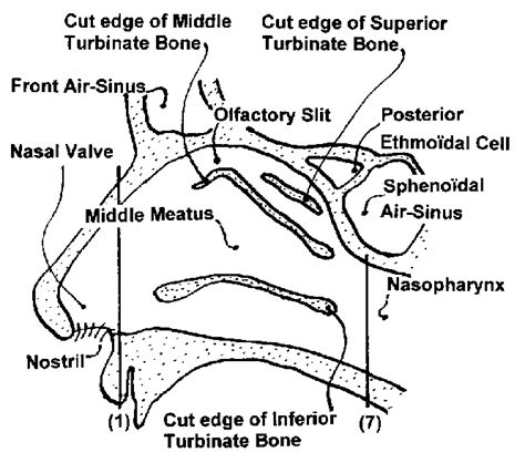 Sagittal View Of The Outer Wall Of The Right Nasal Airway The