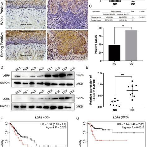 Cervical Cancer Cells With High Expression Of Lgr Have Enhanced