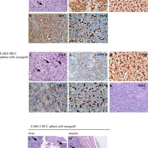 Caki 1 Cancer Spheres Form Larger Xenograft Tumors With Increased Emt Download Scientific