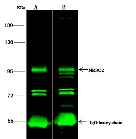 Anti Mineralocorticoid Receptor Nr3c2 Antibody Rabbit Pab 101692 T38