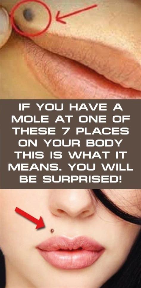 If You Have A Mole At One Of These 7 Places On Your Body This Is What It Means You Will Be