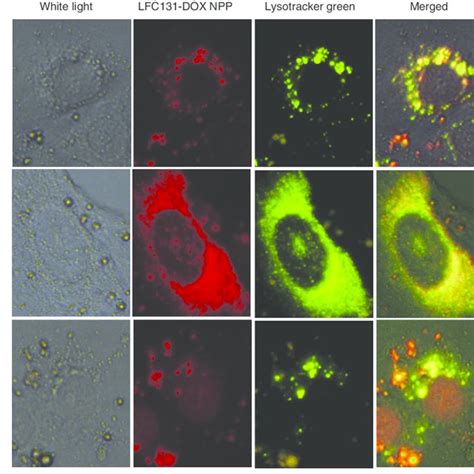 Cellular Uptake Of LFC131 DOX NPs Was Observed By Colocalization Of