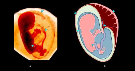 14 Weeks Gestation 3d Human Development