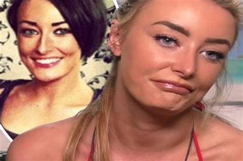 Love Island Chloe Crowhurst S Pal Denies Shes Had Surgery Except For