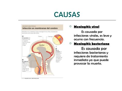 Meningitis