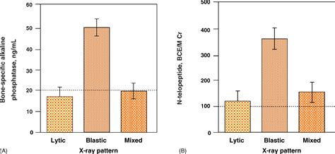 Natural History and Treatment of Bone Complications in Prostate Cancer