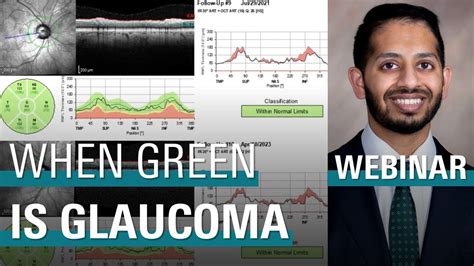 When Green Is Glaucoma Oct Pearls For Clinical Management Of Glaucoma Youtube