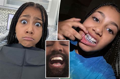 Thepatriotlight North West Gets Diamond Grills As Kanye Debuts