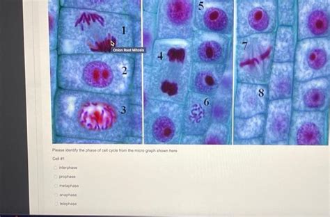 Solved Choose all the cells that can undergo mitosis human | Chegg.com
