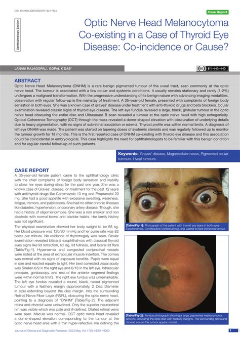 Pdf Optic Nerve Head Melanocytoma Co Existing In A Case Of Thyroid Eye Disease Co Incidence