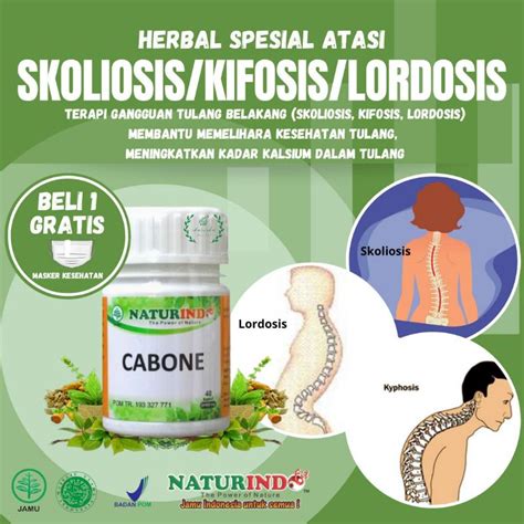 Jual Obat Skoliosis Tulang Bengkok Anak Dan Dewasa Obat Lordosis Obat