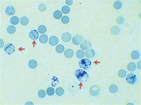 Wrights Stain Preparation Principle Procedure And Results