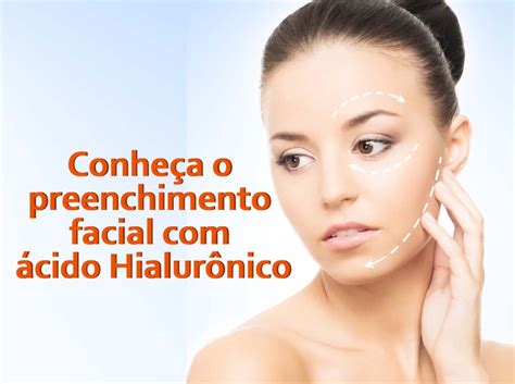 Conheça O Preenchimento Facial Com ácido Hialurônico