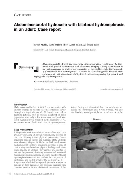 Pdf Abdominoscrotal Hydrocele With Bilateral Hydronephrosis In An