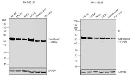 Calreticulin Recombinant Monoclonal Antibody Su37 03 Ma5 32131