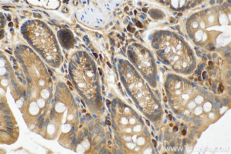 Calreticulin Antibody 10292 1 Ap Proteintech 武汉三鹰生物技术有限公司