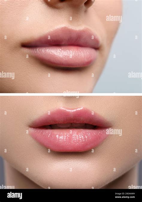 Permanent Makeup Collage With Photos Of Woman Before And After Lip