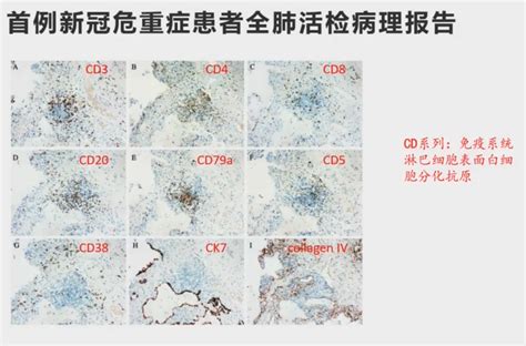 免疫组化IHC染色实验结果解读附视频教程