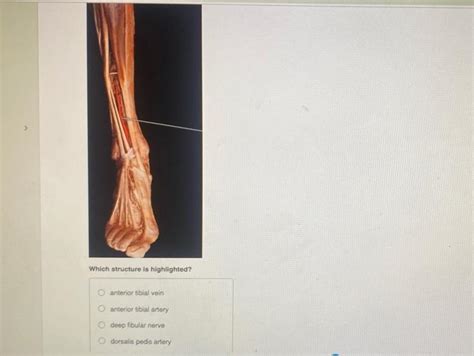 Solved E B F G D H Identify The Blood Vessel Labeled G 2 Chegg