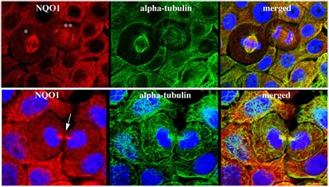 Triple Immunofluorescent Staining For Nqo1 Red Alpha Tubulin Green