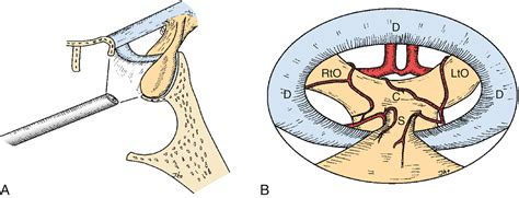 Endoscopic Endonasal Pituitary And Skull Base Surgery Clinical Tree