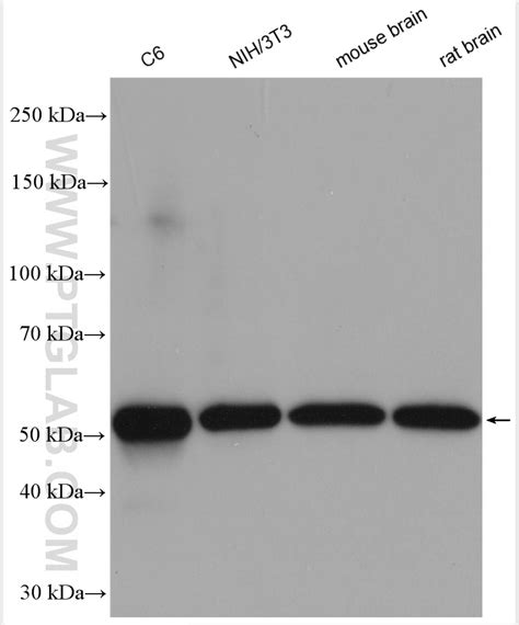 Calreticulin Antibody 27298 1 Ap Proteintech 武汉三鹰生物技术有限公司