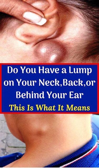 Do You Have A Lump On Your Neck Back Or Behind Your Ear This Is What It