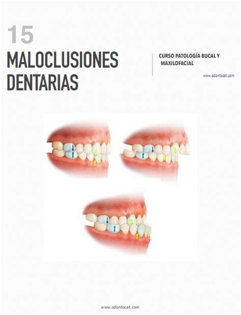 Odontocat Curso Online De Patolog A Bucal Y Maxilofacial