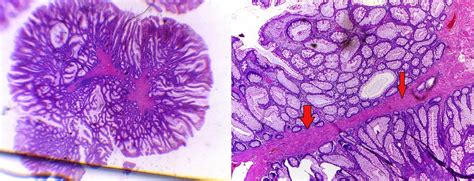 GASTROINTESTINAL AND LIVER HISTOLOGY PATHOLOGY ATLAS: COLON ...