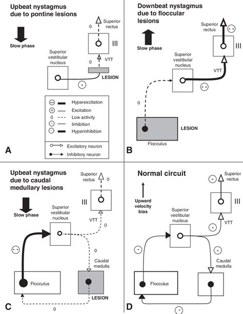 Hypothetical Pathophysiology Of Vertical Nystagmus Only The