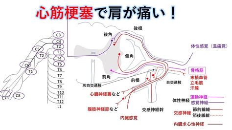 国試対策暗記からの卒業 61話 関連痛 Youtube