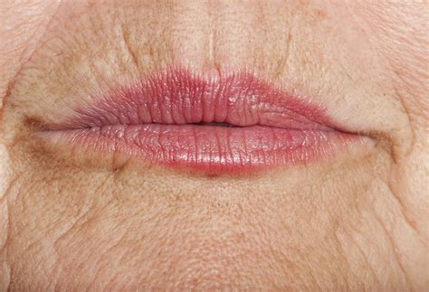 Cómo eliminar el Código de Barras Arrugas en los Labios