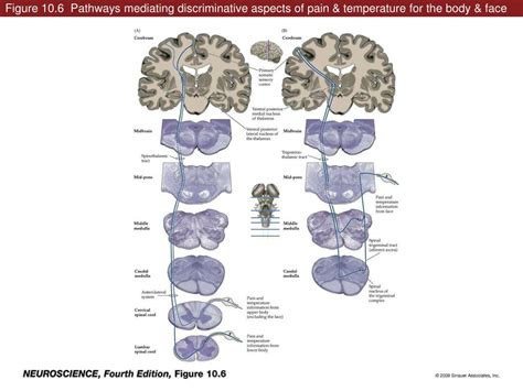 Ppt Figure Experimental Demonstration That Nociception Involves