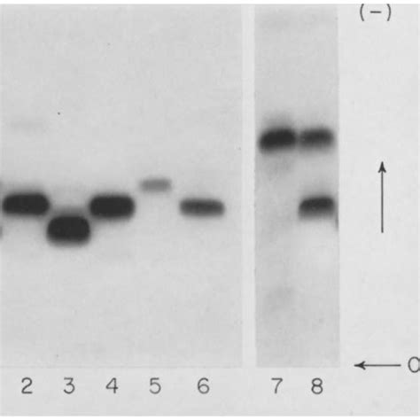 Starch Gel Electrophoretic Comparison Of Different Fractions Of