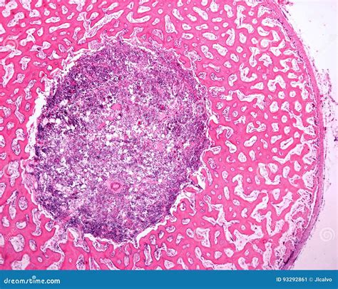 Diaphysis of an Embryonic Bone Stock Image - Image of bone, cell: 93292861