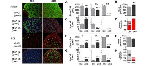 Nebulin deficiency alters fiber-type composition and CSA. Mid-belly... | Download Scientific Diagram