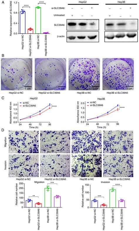 Knockdown Of Slc A Inhibits Liver Cancer Cell Growth Migration And