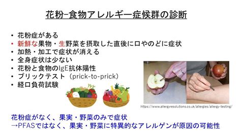 Shigetoshi Kobayashi On Twitter Pfas 花粉症 その③ 花粉食物アレルギー症候群の診断です ☑️