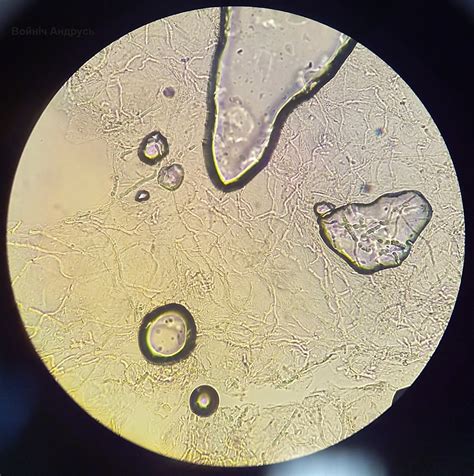 MICROCOSM: Нити мицелия, микроспория