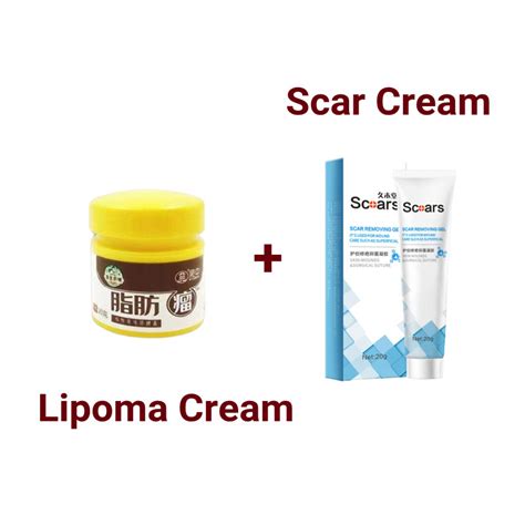 Lipoma Cream Krim Benjolan Removing Multiple Single Lipoma Subcutaneous