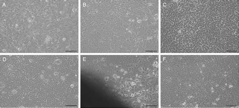 Limbal Epithelial Explant Culture On Pet Membrane Inserts