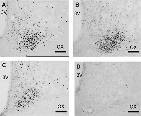 Representative Photomicrographs Showing C Fos Expression In The