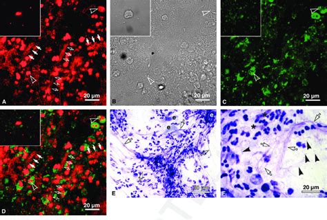 Confocal Laser Scanning Microscopy Optical Slices Of 17 Lm Crevicular