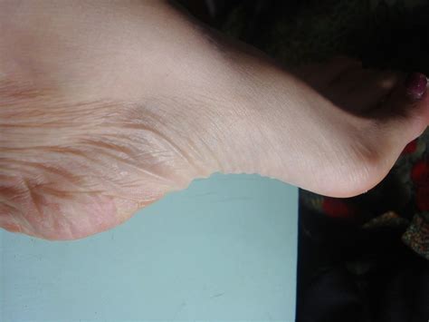 Asian Feet Porn Pics PICTOA