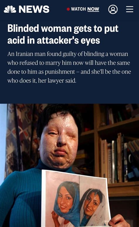 Ameneh Bahrami Was Blinded And Disfigured By A Man Who Poured Acid On Her Face In 2004 She Stood